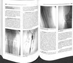 COMPLICACIONES DE LOS PROCEDIMIENTOS ENDOVASCULARES | 9788461702923 | CARLOS VAQUERO PUERTA