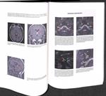 SENTIDOS: ATLAS DE NEUROIMAGEN | 9788496504219 | JUAN BERENGUER GONZALEZ / TERESA PUJOL FARRE