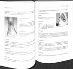 PATOLOGÍA VENOSA: GUÍA DE DIAGNÓSTICO Y TRATAMIENTO DEL CAPÍTULO ESPAÑOL DE FLEBOLOGÍA DE LA SOCIEDAD ESPAÑOLA DE ANGIOLOGÍA Y CIRUGÍA VASCULAR | 9788479892067 | JOSEP MARINEL·LO ROURA / RICARDO GESTO CASTROMIL
