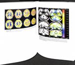 UN CEREBRO FELIZ LA CONQUISTA DE LA ENFERMEDAD MENTAL EN LA ERA DEL GENOMA | 9788497060448 | NANCY C. ANDREASEN