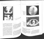 CONCURSO DE CASOS CLÍNICOS DE RESIDENTES DE ANGIOLOGÍA Y CIRUGÍA VASCULAR | 9788479892593 | FERNANDO VAQUERO MORILLO