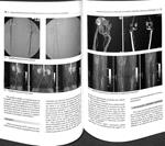CIRUGÍA ENDOVASCULAR DE LAS ARTERIAS DISTALES DEL MIEMBRO INFERIOR | 9788461328772 | CARLOS VAQUERO PUERTA