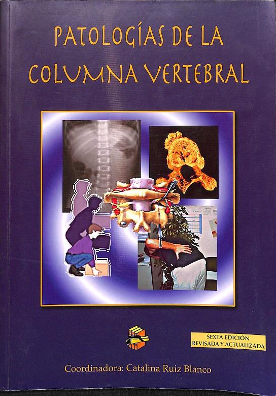 PATOLOGÍAS DE LA COLUMNA VERTEBRAL | CATALINA RUIZ BLANCO