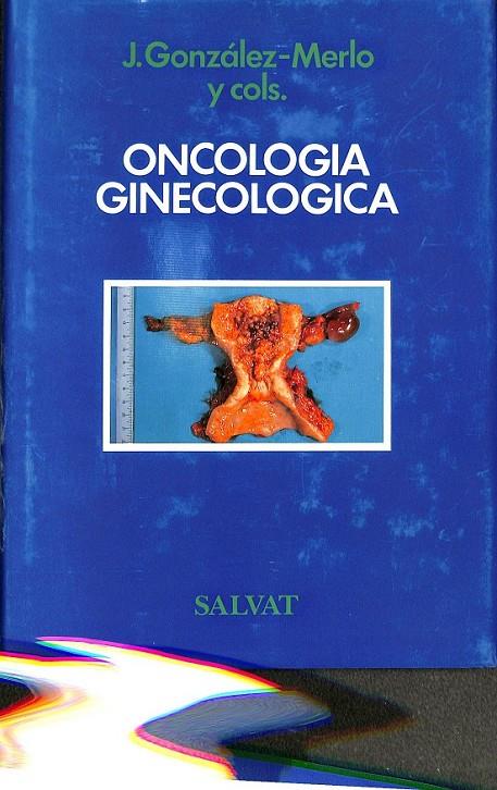ONCOLOGÍA GINECOLÓGICA | 9788434525207 | GONZÁLEZ MERLO, JESÚS