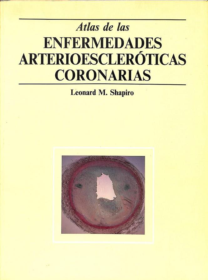 ATLAS DE LAS ENFERMEDADES ARTERIOESCLEROTICAS CORONARIAS  | 9780723418214 | LEONARD M SHAPIRO