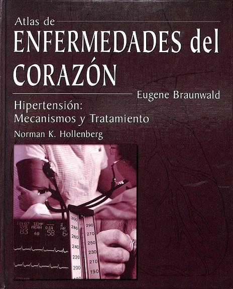 ATLAS DE ENFERMEDADES DEL CORAZÓN | 8488992718