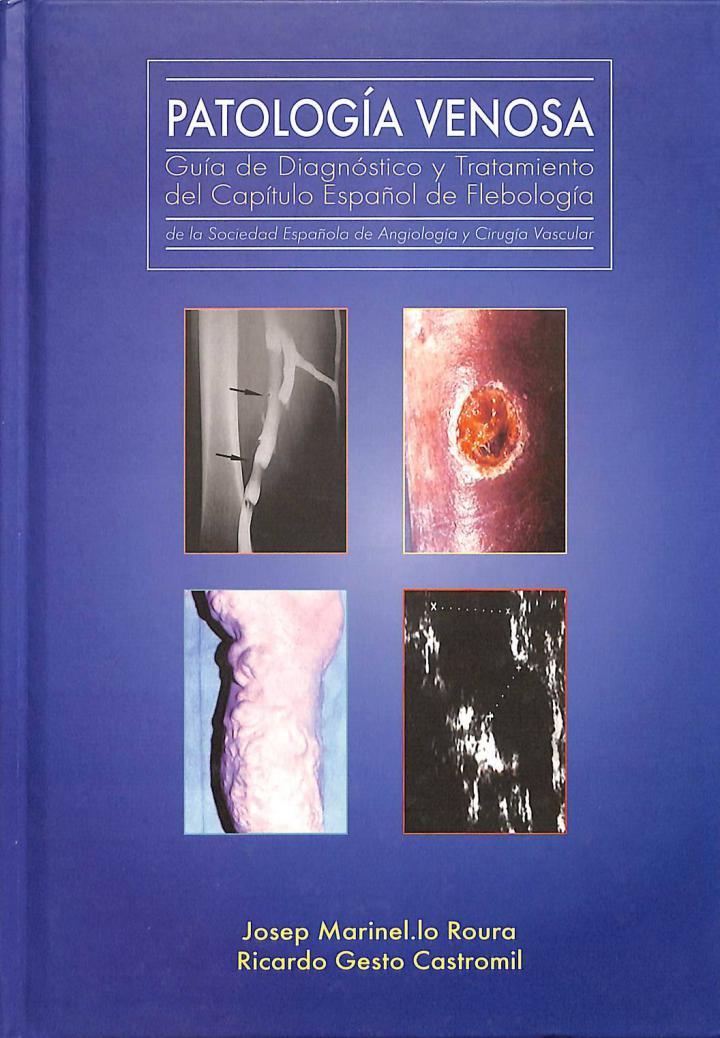 PATOLOGÍA VENOSA: GUÍA DE DIAGNÓSTICO Y TRATAMIENTO DEL CAPÍTULO ESPAÑOL DE FLEBOLOGÍA DE LA SOCIEDAD ESPAÑOLA DE ANGIOLOGÍA Y CIRUGÍA VASCULAR | 9788479892067 | JOSEP MARINEL·LO ROURA / RICARDO GESTO CASTROMIL