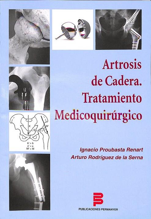 ARTROSIS DE CADERA | 9788496762572 | PROUBASTA RENART, IGNACIO / RODRÍGUEZ DE LA SERNA, ARTURO
