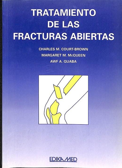 TRATAMIENTO FRACTURAS ABIERTAS | 9788478772138