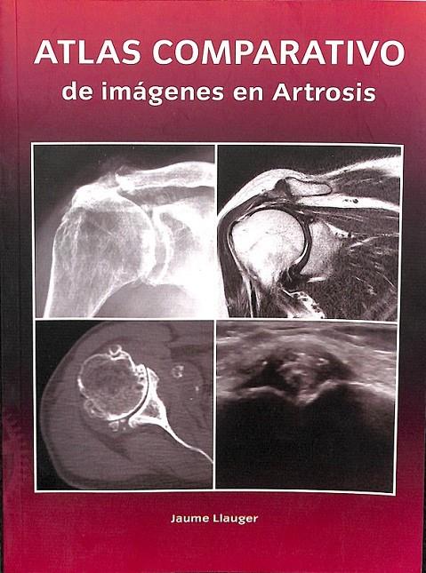 ATLAS COMPARATIVO DE IMAGENES EN ARTROSIS  | 9788493709242 | JAUME LLAUGER