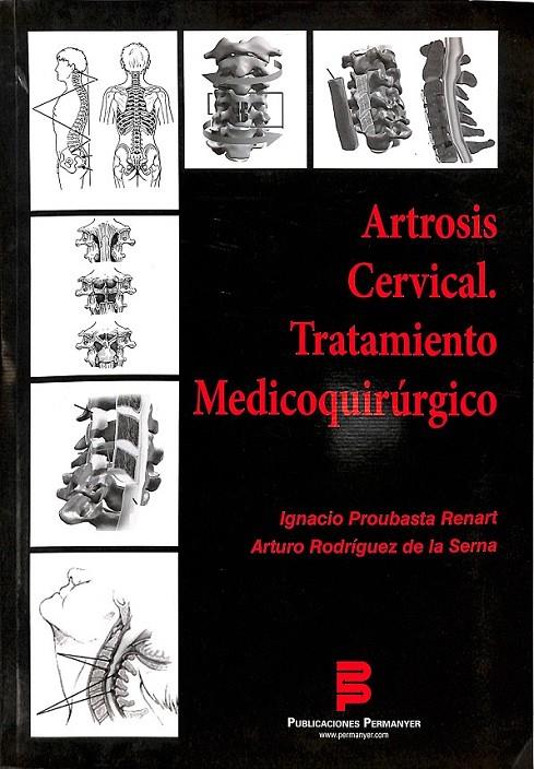 ARTROSIS CERVICAL TRATAMIENTO MEDICOQUIRURGICO  | 9788492620036 | IGNACIO PROUBASTA RENART