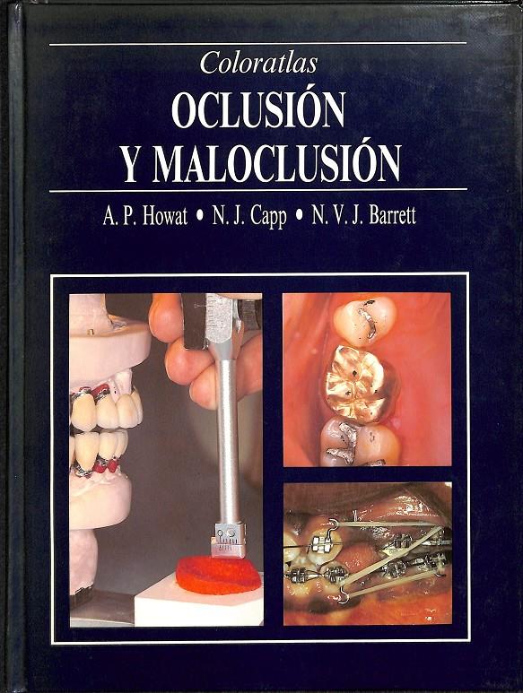 OCLUSION Y MALOCLUSION | 9780723417664 | A.P. HOWAT
