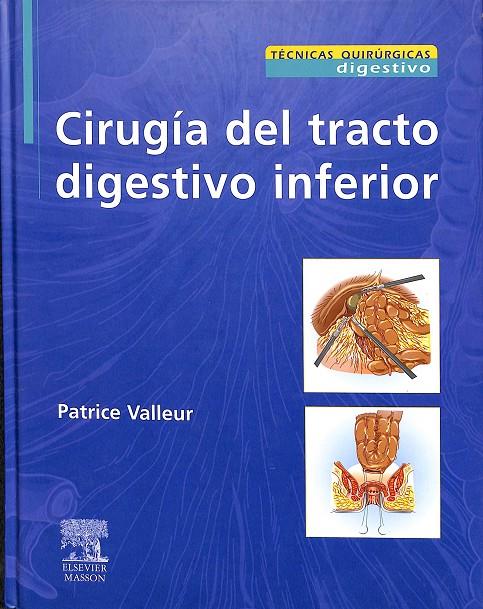 CIRUGÍA DEL TRACTO DIGESTIVO INFERIOR | PATRICE VALLEUR