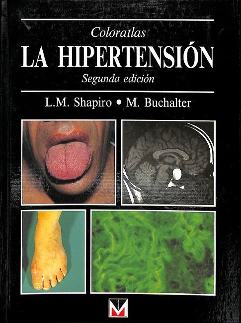 LA HIPERTENSION  | SHAPPIRO  BUCHALTER
