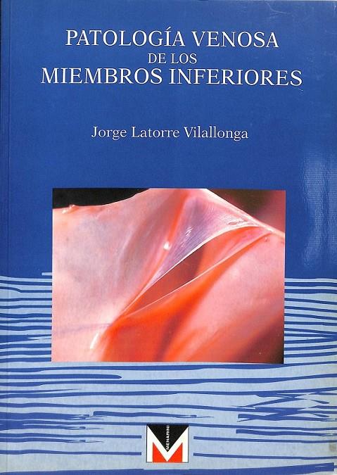 PATOLOGIA VENOSA DE LOS MIEMBROS INFERIORES  | JORGE LATORRE VILLALONGA