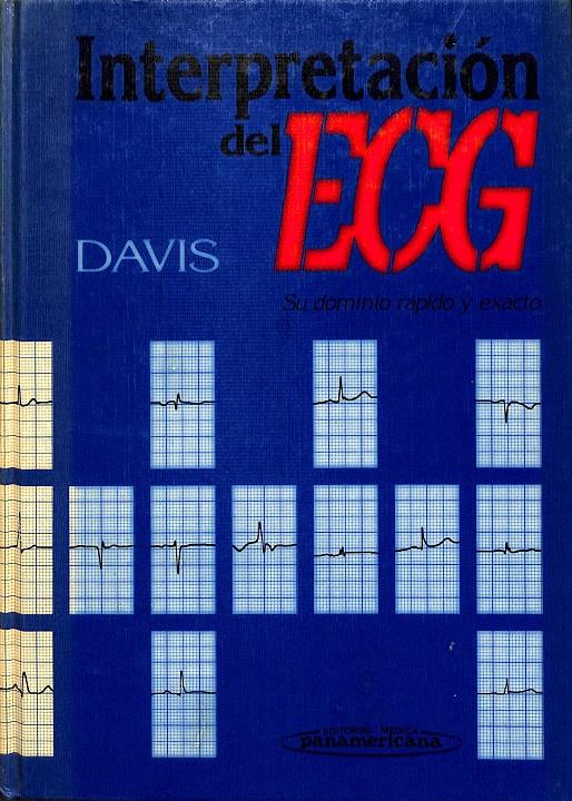 INTERPRETACIÓN DEL ECG | DALE DAVIS