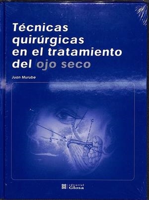TÉCNICAS QUIRÚRGICAS EN EL TRATAMIENTO DEL OJO SECO | MURUBE DEL CASTILLO, JUAN