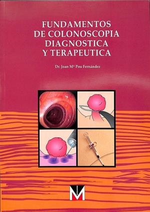 FUNDAMENTOS DE COLONOSCOPIA DIAGNÓSTICA Y TERAPÉUTICA | POU FERNÁNDEZ, JOAN MARIA