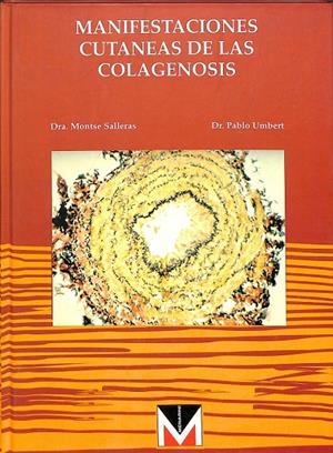 MANIFESTACIONES CUTANEAS DE LAS COLAGENOSIS  | MONTSE SALLERAS PABLO UMBERT