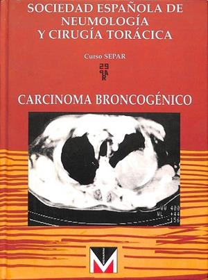 CARCINOMA BRONCOGÉNICO | SOCIEDAD ESPAÑOLA DE APARATO RESPIRATORIO