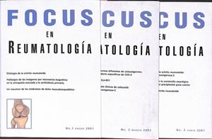 FOCUS EN REUMATOLOGIA (TOMOS 1,2,3)