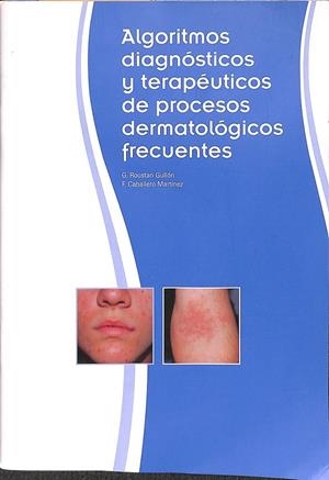 ALGORITMOS DIAGNOSTICOS Y TERAPEUTICOS DE PROCESOS DERMATOLOGICOS FRECUENTES | ROUSTAN GULLON CABALLERO MARTINEZ