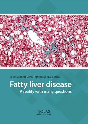 FATTY LIVER DISEASE (INGLÉS) | OLCOZ GOÑI, JOSE LUIS / JORQUERA PLAZA, FRANCISCO