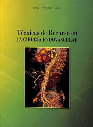 TÉCNICAS DE RECURSO EN LA CIRUGÍA ENDOVASCULAR | CARLOS VAQUERO PUERTA