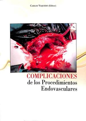 COMPLICACIONES DE LOS PROCEDIMIENTOS ENDOVASCULARES | CARLOS VAQUERO PUERTA