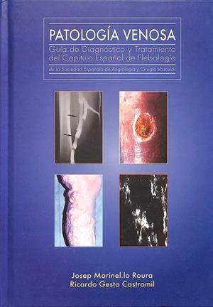 PATOLOGÍA VENOSA: GUÍA DE DIAGNÓSTICO Y TRATAMIENTO DEL CAPÍTULO ESPAÑOL DE FLEBOLOGÍA DE LA SOCIEDAD ESPAÑOLA DE ANGIOLOGÍA Y CIRUGÍA VASCULAR | JOSEP MARINEL·LO ROURA / RICARDO GESTO CASTROMIL