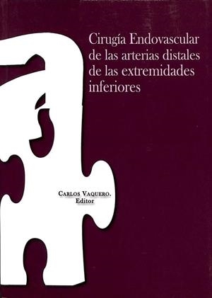 CIRUGÍA ENDOVASCULAR DE LAS ARTERIAS DISTALES DEL MIEMBRO INFERIOR | CARLOS VAQUERO PUERTA