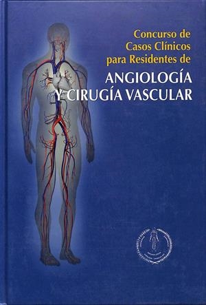 CONCURSO DE CASOS CLÍNICOS DE RESIDENTES DE ANGIOLOGÍA Y CIRUGÍA VASCULAR | FERNANDO VAQUERO MORILLO