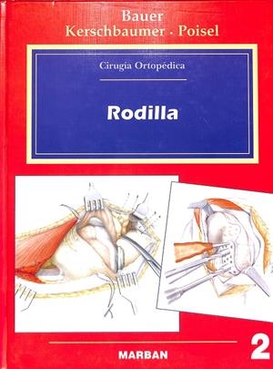 RODILLA CIRUGIA ORTOPEDICA | BAUER, RUDOLF / KERSCHBAUMER, FRIDUN / POISEL, SEPP