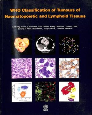 WHO CLASSIFICATION OF TUMOURS OF HAEMATOPOIETIC AND LYMPHOID TISSUES - (INGLÉS) | VARIOS
