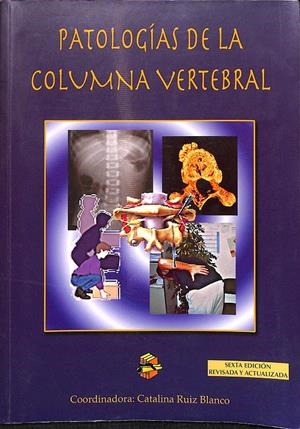PATOLOGÍAS DE LA COLUMNA VERTEBRAL | CATALINA RUIZ BLANCO