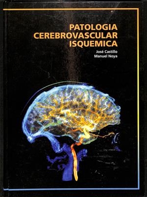 PATOLOGIS CEREBROVASCULAR ISQUEMICA | JOSÉ CASTILLO - MANUEL NOYA
