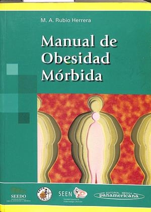 MANUAL DE OBESIDAD MÓRBIDA | RUBIO HERRERA, MIGUEL ÁNGEL