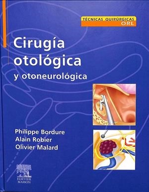 CIRUGÍA OTOLÓGICA Y OTONEUROLÓGICA | PHILIPPE BORDURE; ALAN ROBIER; OLIVIER MALARD